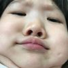 mylosee2