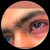 liglyeya6