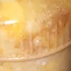 i35791115