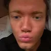 martinnymark2