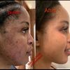 skincarefacial2