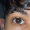 y_mala1
