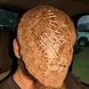 balorbone