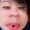 yongx444