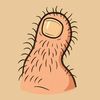 hairymidgettoe