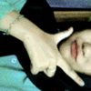 vlynmr