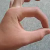 flammenlaser