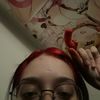 bruisedtooth_