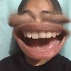 esterasholong