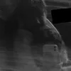 blbrl1