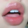 neoz526
