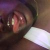 mide5561