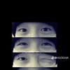 mylvcb