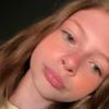 harperpigmintation19
