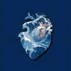 pacemaker1308