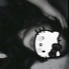 musiclover_xoxo