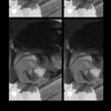 alilinaputri