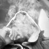 marrwsd_