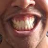 prontofalo