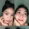 .frn_dvn
