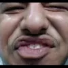 3absi6