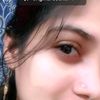 sarminaktheralamin