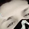 5_zxvca