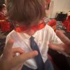 liambaerg09