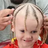 hyperpigmentskibidi