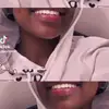 missdimple62