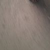 bonefracture_