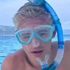 ottos_gesichtsunfall