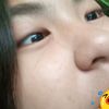 rhel00i
