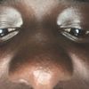 diop_mvker44