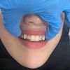 Behel_Gigi Madura🦷