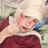 Ervina