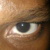 shallzx1_