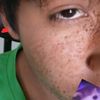 abel_2864