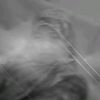 n.a_mel03