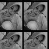 nyl_ptrinbilaa