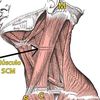 esternocleidomasto0