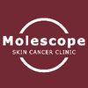 molescope