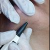 Electrolysis