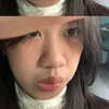 btranxih1