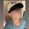bobscar8