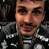 manusepp
