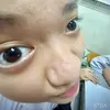 ndnbbpc