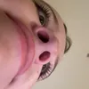 molezze