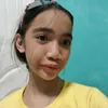 Dimps