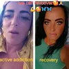 recovery431loopylou